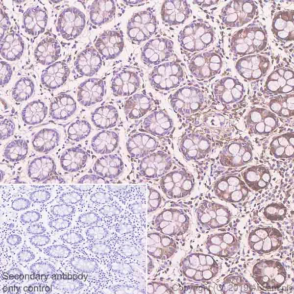 Immunohistochemistry (Formalin/PFA-fixed paraffin-embedded sections) - Anti-Carbonic Anhydrase 1/CA1 antibody [EPR23232-286] - BSA and Azide free (AB269951)