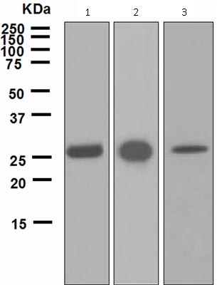 Western blot - Anti-Carbonic Anhydrase 1/CA1 antibody [EPR5192] (AB124976)