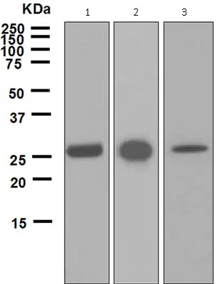 Western blot - Anti-Carbonic Anhydrase 1/CA1 antibody [EPR5192] (AB124976)
