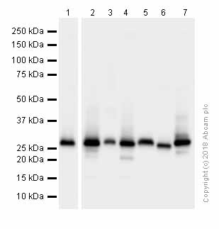 Anti-Carbonic Anhydrase 1/CA1 antibody [EPR5193]