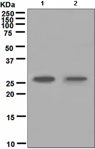 Western blot - Anti-Carbonic Anhydrase 1/CA1 antibody [EPR5193] (AB108367)