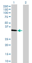 Western blot - Anti-Carbonic anhydrase 10/CA10 antibody (AB69143)