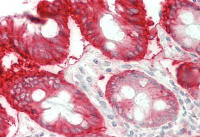 Immunohistochemistry (Formalin/PFA-fixed paraffin-embedded sections) - Anti-Carbonic Anhydrase 12/CA12 antibody (AB218983)