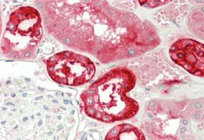 Immunohistochemistry (Formalin/PFA-fixed paraffin-embedded sections) - Anti-Carbonic Anhydrase 12/CA12 antibody (AB218983)