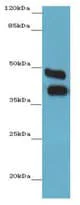 Western blot - Anti-Carbonic Anhydrase 12/CA12 antibody (AB218983)