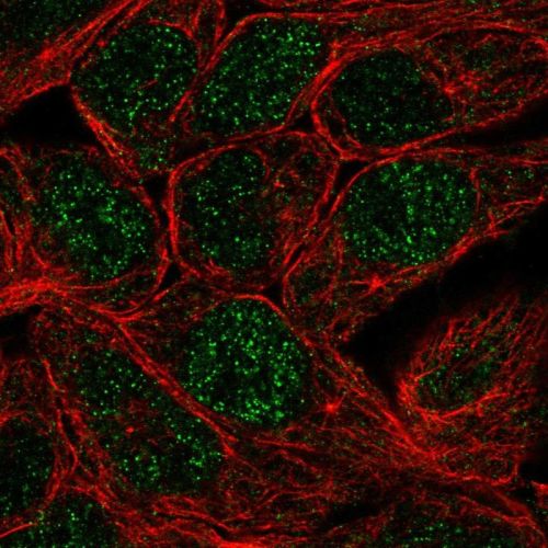 Immunocytochemistry/ Immunofluorescence - Anti-Carbonic Anhydrase 12/CA12 antibody (AB244309)