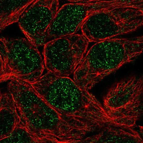 Immunocytochemistry/ Immunofluorescence - Anti-Carbonic Anhydrase 12/CA12 antibody (AB244309)