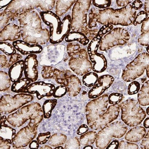 Immunohistochemistry (Formalin/PFA-fixed paraffin-embedded sections) - Anti-Carbonic Anhydrase 12/CA12 antibody (AB244309)