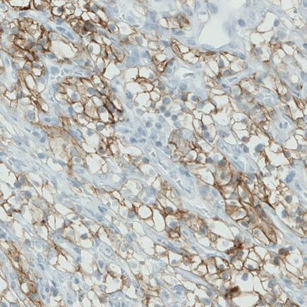 Immunohistochemistry (Formalin/PFA-fixed paraffin-embedded sections) - Anti-Carbonic Anhydrase 12/CA12 antibody [CL0278] (AB242316)