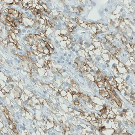 Immunohistochemistry (Formalin/PFA-fixed paraffin-embedded sections) - Anti-Carbonic Anhydrase 12/CA12 antibody [CL0278] (AB242316)
