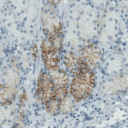 Immunohistochemistry (Formalin/PFA-fixed paraffin-embedded sections) - Anti-Carbonic Anhydrase 12/CA12 antibody [CL0278] (AB242316)