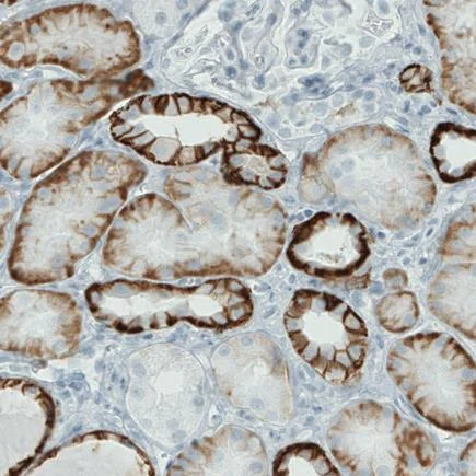 Immunohistochemistry (Formalin/PFA-fixed paraffin-embedded sections) - Anti-Carbonic Anhydrase 12/CA12 antibody [CL0278] (AB242316)