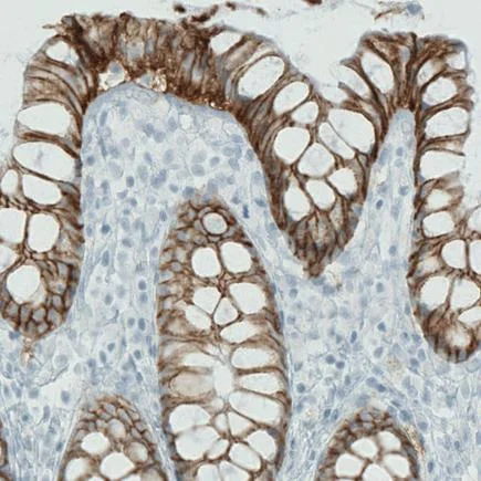Immunohistochemistry (Formalin/PFA-fixed paraffin-embedded sections) - Anti-Carbonic Anhydrase 12/CA12 antibody [CL0278] (AB242316)