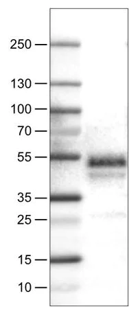 Western blot - Anti-Carbonic Anhydrase 12/CA12 antibody [CL0278] (AB242316)