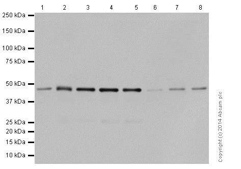 Western blot - Anti-Carbonic Anhydrase 12/CA12 antibody [EPR14861] - BSA and Azide free (AB236138)