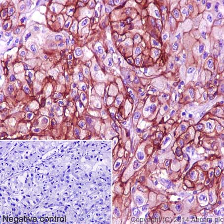 Immunohistochemistry (Formalin/PFA-fixed paraffin-embedded sections) - Anti-Carbonic Anhydrase 12/CA12 antibody [EPR14861] - C-terminal (ab195233), expandable thumbnail
