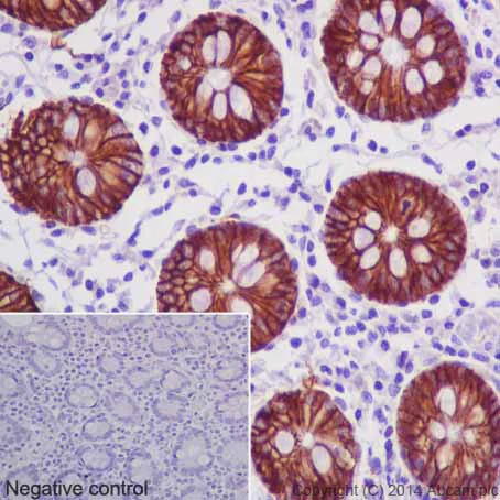 Immunohistochemistry (Formalin/PFA-fixed paraffin-embedded sections) - Anti-Carbonic Anhydrase 12/CA12 antibody [EPR14861] - C-terminal (AB195233)