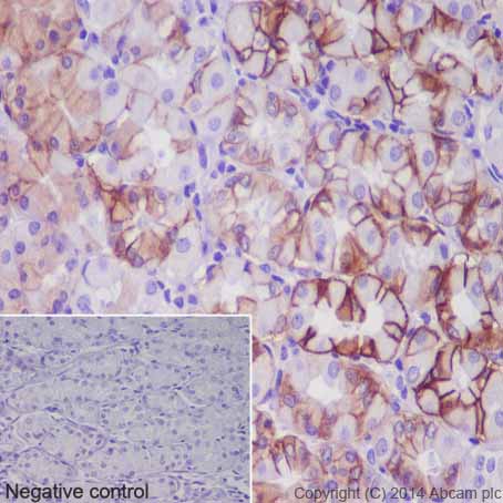Immunohistochemistry (Formalin/PFA-fixed paraffin-embedded sections) - Anti-Carbonic Anhydrase 12/CA12 antibody [EPR14861] - C-terminal (AB195233), expandable thumbnail