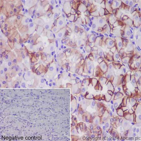 Immunohistochemistry (Formalin/PFA-fixed paraffin-embedded sections) - Anti-Carbonic Anhydrase 12/CA12 antibody [EPR14861] - C-terminal (AB195233)