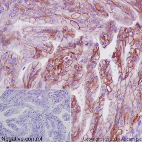 Immunohistochemistry (Formalin/PFA-fixed paraffin-embedded sections) - Anti-Carbonic Anhydrase 12/CA12 antibody [EPR14861] - C-terminal (ab195233), expandable thumbnail