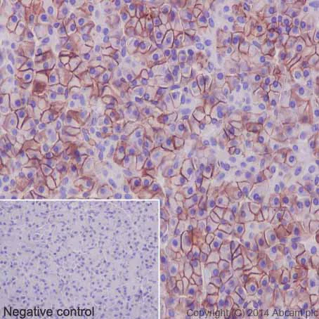Immunohistochemistry (Formalin/PFA-fixed paraffin-embedded sections) - Anti-Carbonic Anhydrase 12/CA12 antibody [EPR14861] - C-terminal (AB195233)