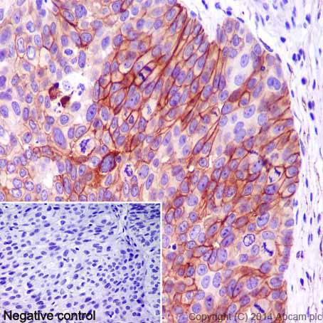 Immunohistochemistry (Formalin/PFA-fixed paraffin-embedded sections) - Anti-Carbonic Anhydrase 12/CA12 antibody [EPR14861] - C-terminal (ab195233), expandable thumbnail