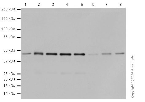 Western blot - Anti-Carbonic Anhydrase 12/CA12 antibody [EPR14861] - C-terminal (AB195233), expandable thumbnail