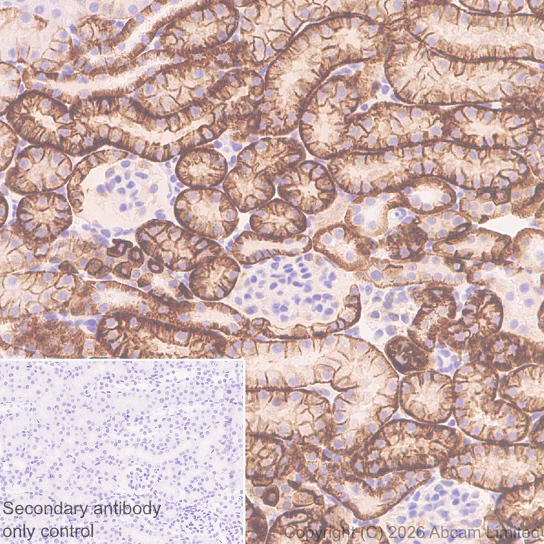 Immunohistochemistry (Formalin/PFA-fixed paraffin-embedded sections) - Anti-Carbonic Anhydrase 12/CA12 antibody [EPR29798-669] (AB326096)
