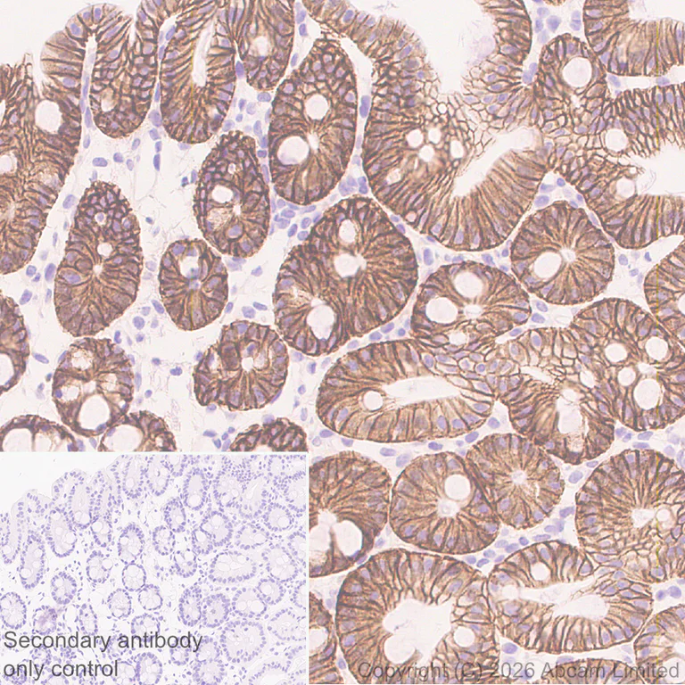 Immunohistochemistry (Formalin/PFA-fixed paraffin-embedded sections) - Anti-Carbonic Anhydrase 12/CA12 antibody [EPR29798-669] (AB326096)