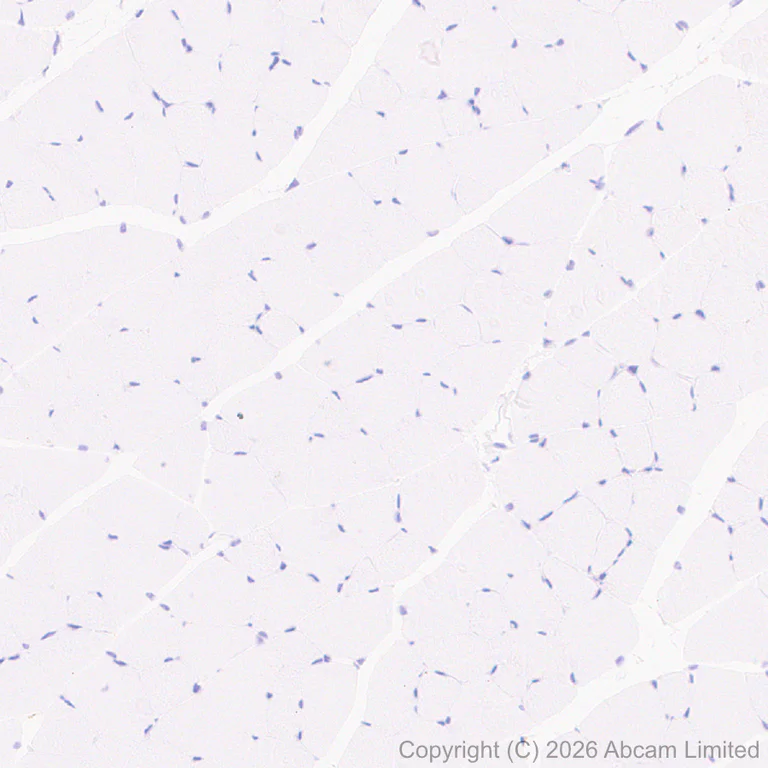 Immunohistochemistry (Formalin/PFA-fixed paraffin-embedded sections) - Anti-Carbonic Anhydrase 12/CA12 antibody [EPR29798-669] (AB326096)