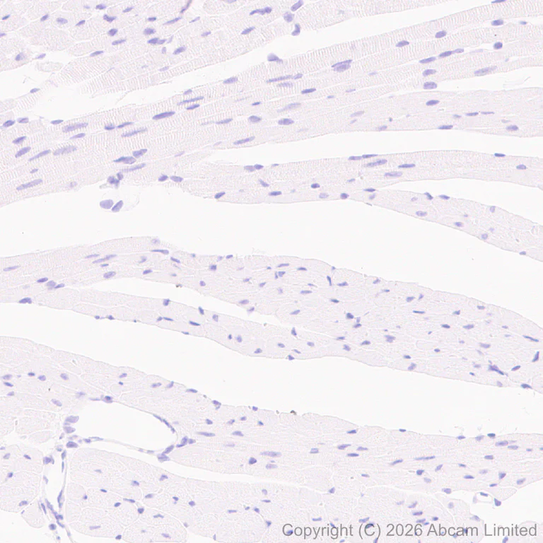 Immunohistochemistry (Formalin/PFA-fixed paraffin-embedded sections) - Anti-Carbonic Anhydrase 12/CA12 antibody [EPR29798-669] (AB326096)