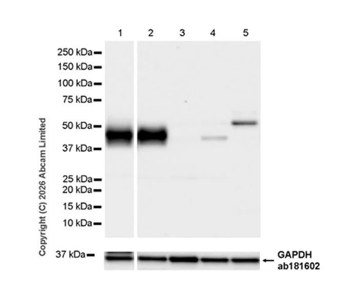Western blot - Anti-Carbonic Anhydrase 12/CA12 antibody [EPR29798-669] (AB326096)