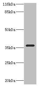 Western blot - Anti-Carbonic Anhydrase 13/CA13 antibody (AB236579), expandable thumbnail