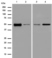 Carbonic Anhydrase 14/CA14抗体[EPR14307] (ab184180)| Abcam中文官网