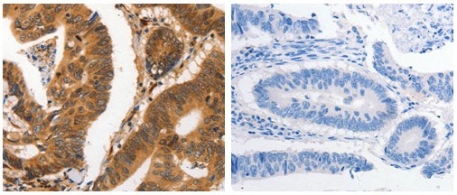 Immunohistochemistry (Formalin/PFA-fixed paraffin-embedded sections) - Anti-Carbonic anhydrase 2/CA2 antibody (AB182611), expandable thumbnail