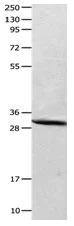 Western blot - Anti-Carbonic anhydrase 2/CA2 antibody (AB182611)