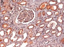 Immunohistochemistry (Formalin/PFA-fixed paraffin-embedded sections) - Anti-Carbonic anhydrase 2/CA2 antibody (AB191343)