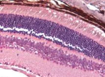 Immunohistochemistry (Formalin/PFA-fixed paraffin-embedded sections) - Anti-Carbonic anhydrase 2/CA2 antibody (AB191343)