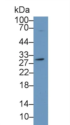Western blot - Anti-Carbonic anhydrase 2/CA2 antibody (AB231153)