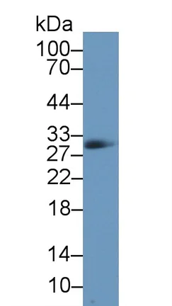 Western blot - Anti-Carbonic anhydrase 2/CA2 antibody (AB231153)