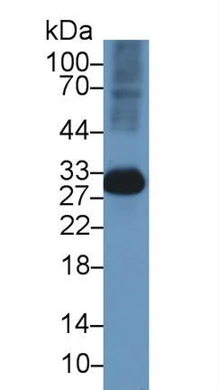 Western blot - Anti-Carbonic anhydrase 2/CA2 antibody (AB231153)
