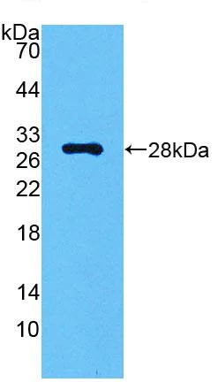 Western blot - Anti-Carbonic anhydrase 2/CA2 antibody (AB231153)