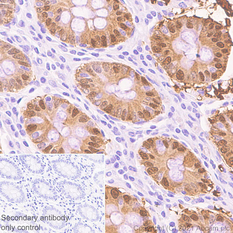 Immunohistochemistry (Formalin/PFA-fixed paraffin-embedded sections) - Anti-Carbonic anhydrase 2/CA2 antibody [EPR5195] (AB124687)