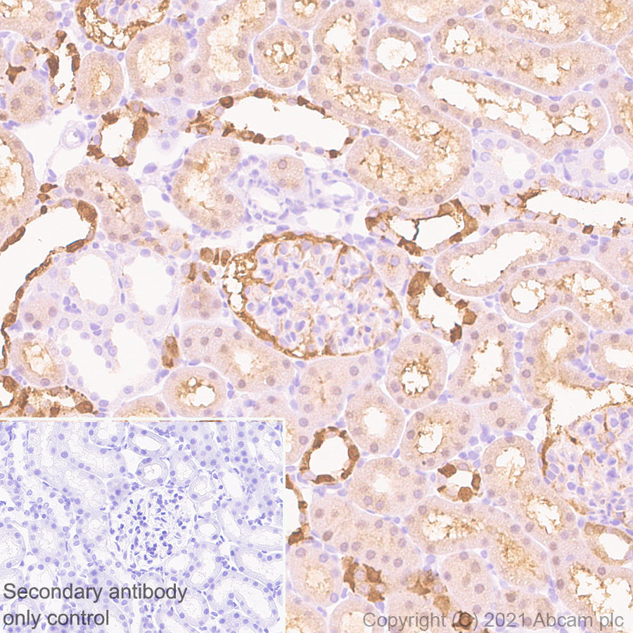 Immunohistochemistry (Formalin/PFA-fixed paraffin-embedded sections) - Anti-Carbonic anhydrase 2/CA2 antibody [EPR5195] (AB124687)