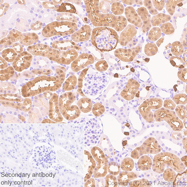 Immunohistochemistry (Formalin/PFA-fixed paraffin-embedded sections) - Anti-Carbonic anhydrase 2/CA2 antibody [EPR5195] - BSA and Azide free (AB222480)