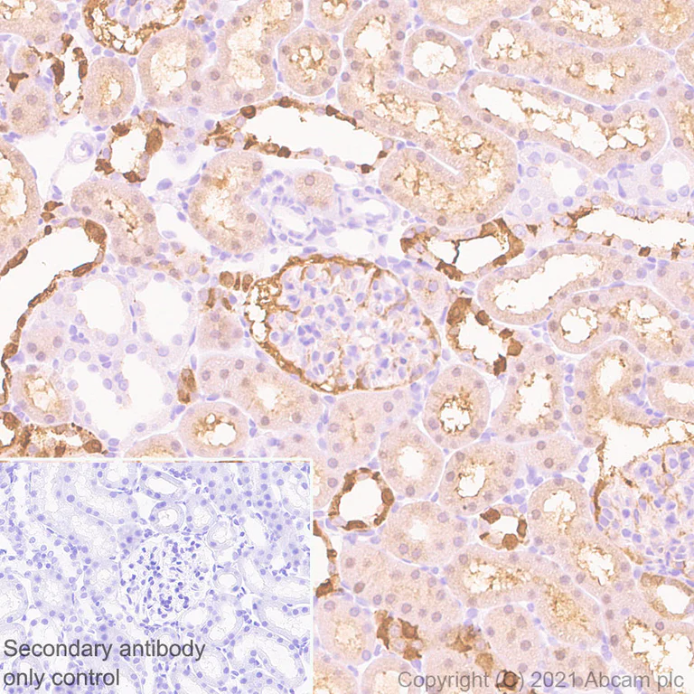 Immunohistochemistry (Formalin/PFA-fixed paraffin-embedded sections) - Anti-Carbonic anhydrase 2/CA2 antibody [EPR5195] - BSA and Azide free (AB222480)