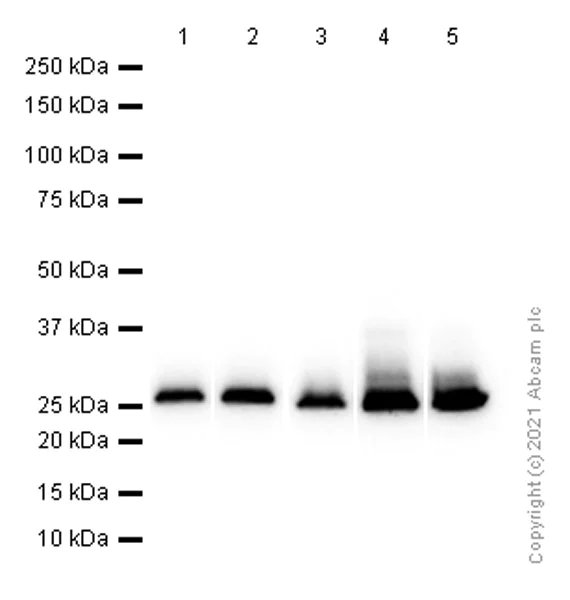 Western blot - Anti-Carbonic anhydrase 2/CA2 antibody [EPR5195] - BSA and Azide free (AB222480)