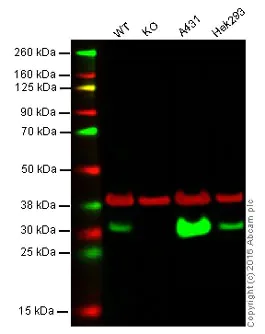 Western blot - Anti-Carbonic anhydrase 2/CA2 antibody [EPR5195] - BSA and Azide free (AB222480)