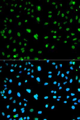 Immunocytochemistry/ Immunofluorescence - Anti-Carbonic Anhydrase 3/CA3 antibody (AB196835), expandable thumbnail