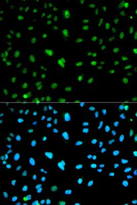 Immunocytochemistry/ Immunofluorescence - Anti-Carbonic Anhydrase 3/CA3 antibody (AB196835)